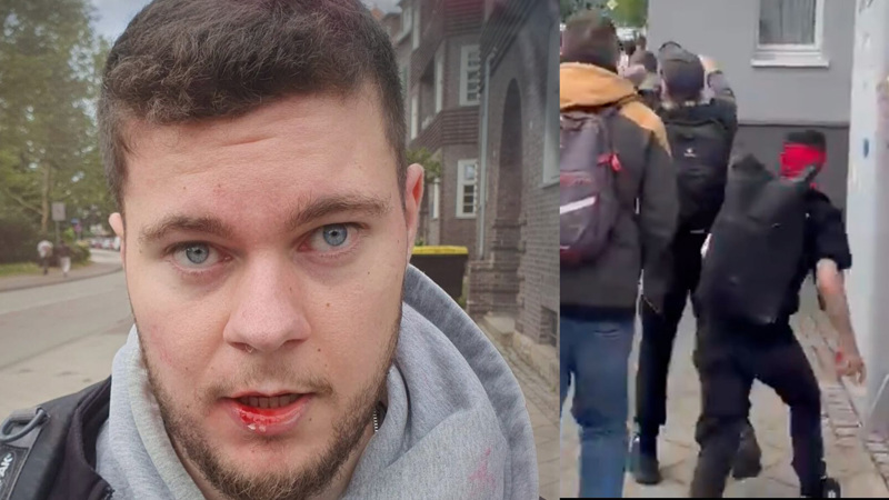 Apollo-News-Reporter Jonas Aston wurde von Linksextremisten blutig geprügelt, nachdem er eine Sitzblockade filmte. Einem anderen Apollo-Reporter wurde von hinten eine Flasche auf den Kopf gehauen.